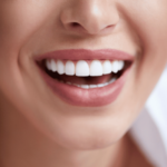 Saiba como conseguir um implante pelo SUS